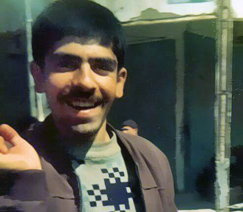 استخوان شکسته